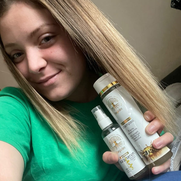 GOLDEN Scalp Serum™-pre upokojenie suchej, svrbivej, podráždenej či citlivej vlasovej pokožky - The Garden - expertnavlasy.sk